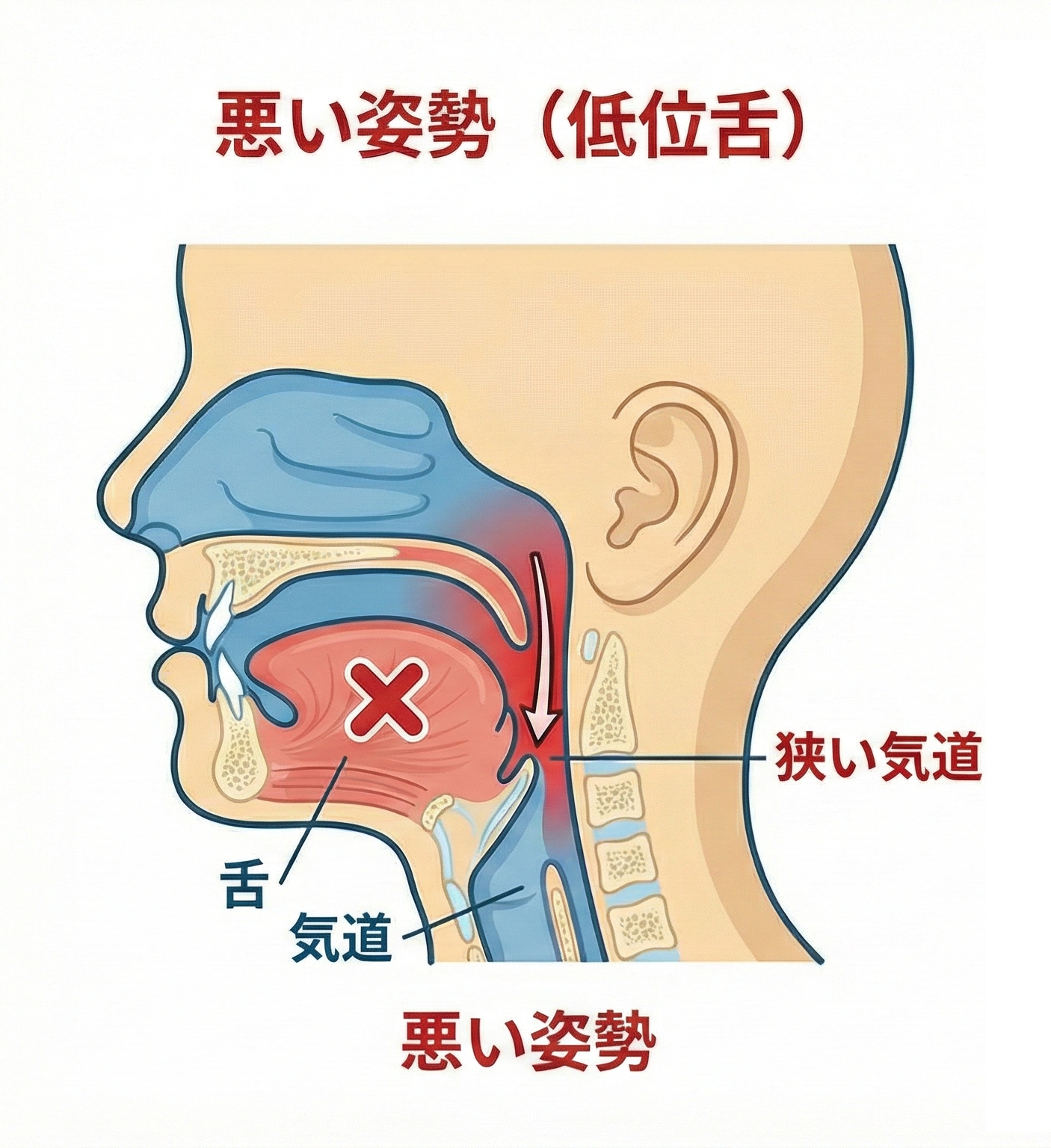 悪い例：舌が下がっている